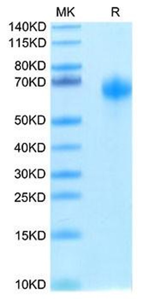 Biotinylated Recombinant Human IL-1R3/IL-1RAcP/IL1RAP Protein (RPCB0060) Biotinylated Recombinant Human IL-1R3/IL-1RAcP/IL1RAP Protein (RPCB0060)
