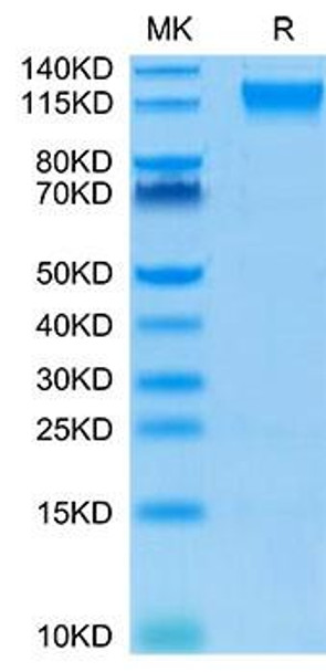 Biotinylated Recombinant Human Semaphorin-4D/SEMA4D/CD100 Protein (RPCB0073)