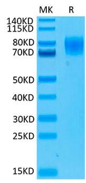 Biotinylated Recombinant Human IFNAR1 Protein (RPCB0079)