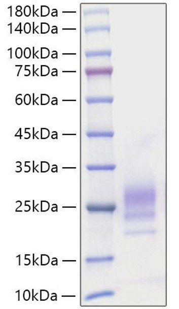 Recombinant Mouse IL-7 Protein (RPCB0094)