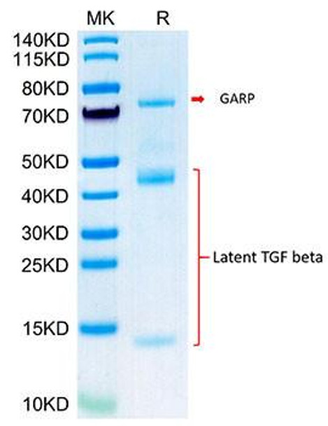 Biotinylated Recombinant Mouse GARP&Latent TGF beta 1 Complex Protein (RPCB0097)