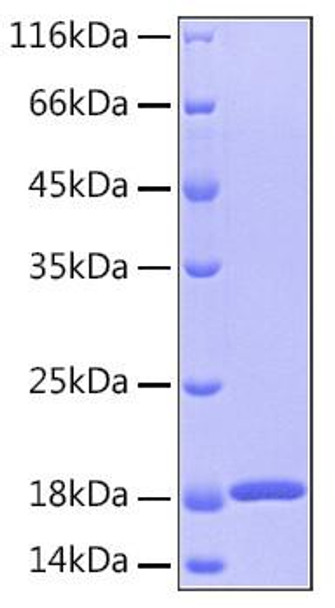Recombinant Human GMF-Beta/GMFB Protein (RPCB0138) Recombinant Human GMF-Beta/GMFB Protein (RPCB0138)