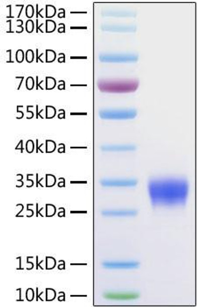 Recombinant Human Fc gamma RIIB/FCGR2B/CD32b Protein (RPCB0153)