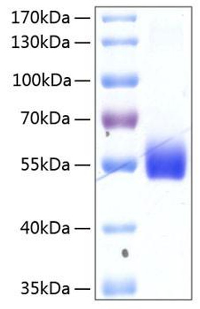 Recombinant Human TNFRSF14/HVEM/CD270 Protein (RPCB0175)