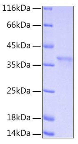 Recombinant Human IkB-alpha/NFKBIA Protein (RPCB0179) Recombinant Human IkB-alpha/NFKBIA Protein (RPCB0179)