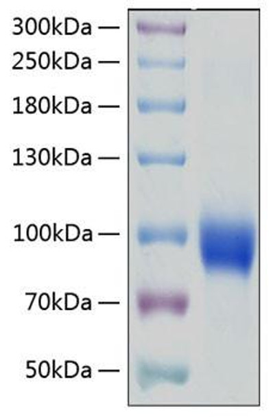 Recombinant Human IL-18R1/CD218a Protein (RPCB0194) Recombinant Human IL-18R1/CD218a Protein (RPCB0194)