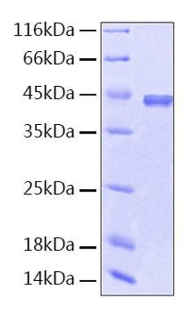 Recombinant Human Serpin F1/PEDF Protein (RPCB0201) Recombinant Human Serpin F1/PEDF Protein (RPCB0201)