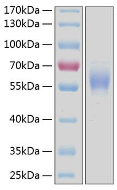 Recombinant Human DDR2/CD167b Protein (RPCB0206)