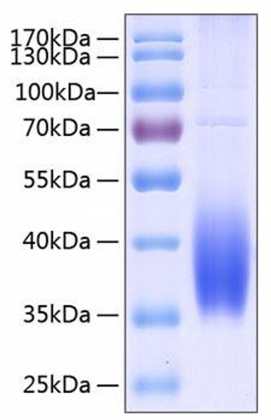 Recombinant Human B7-DC/PD-L2/CD273 Protein (RPCB0211)