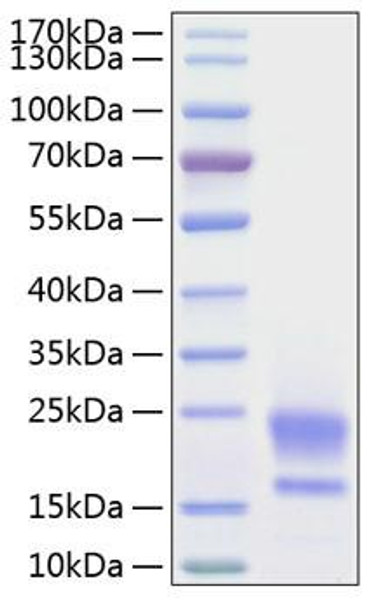 Recombinant Human WAP5/WFDC2/HE4 Protein (RPCB0216) Recombinant Human WAP5/WFDC2/HE4 Protein (RPCB0216)