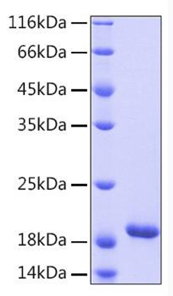 Recombinant Human IL-33 Protein (RPCB0221) Recombinant Human IL-33 Protein (RPCB0221)
