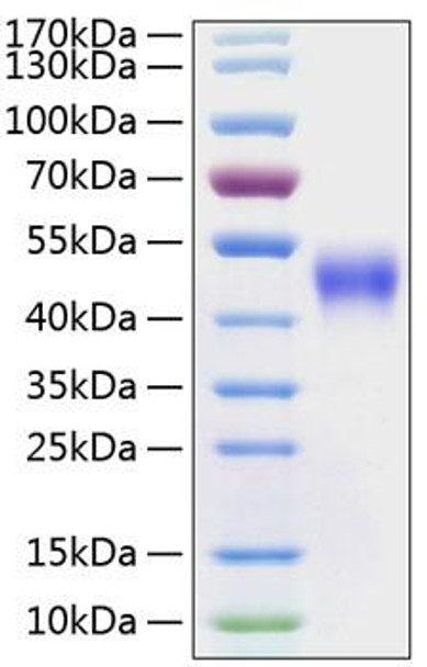 Recombinant Human Fc-gamma RIII alpha/FCGR3A/CD16a Protein (RPCB0224)