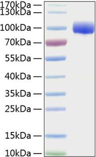 Recombinant Human FGFR-4/CD334 Protein (RPCB0225)