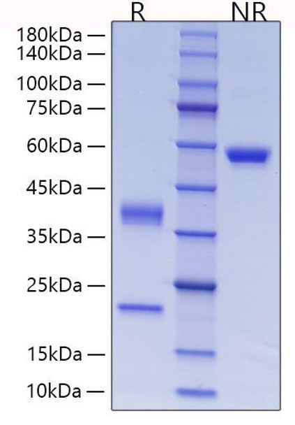 Recombinant Human Complement C1r subcomponent Protein (RPCB0226)