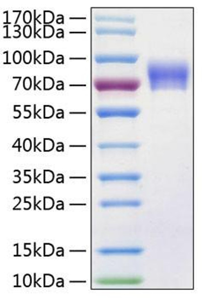 Recombinant Human Vanin-1/VNN1 Protein (RPCB0228) Recombinant Human Vanin-1/VNN1 Protein (RPCB0228)