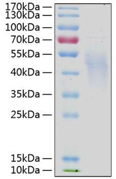 Recombinant Human IL-4R alpha/CD124 Protein (RPCB0232)