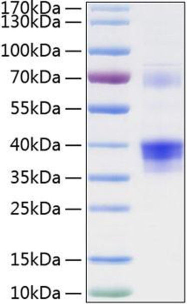 Recombinant Human Clusterin/Apo-J/CLU Protein (RPCB0264)