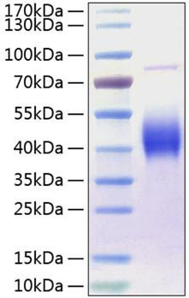 Recombinant Human B7-1/CD80 Protein (RPCB0269)