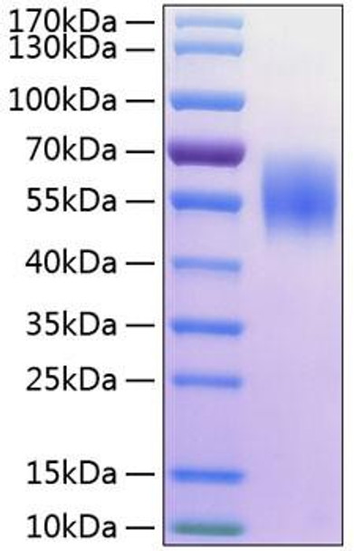 Recombinant Human MHC class I polypeptide-related sequence A/MIC-A Protein (RPCB0286)