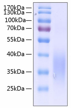 Recombinant Human c-Kit ligand/KITLG/SCF Protein (RPCB0290)