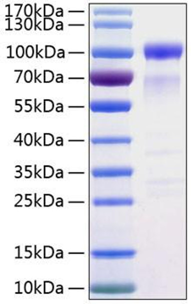 Recombinant Human SIRP-alpha/CD172a Protein (RPCB0297)