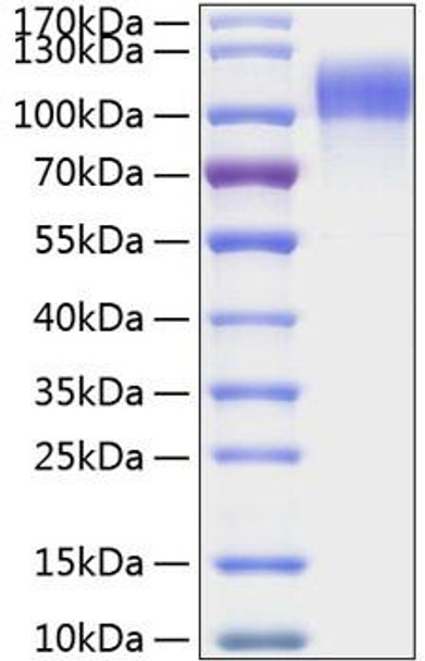 Recombinant Human HER1/ERBB1/EGFR Protein (RPCB0313)