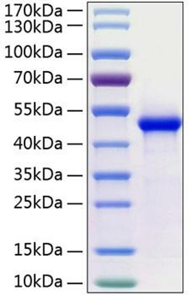 Recombinant Human WIF-1(Q166K) Protein (RPCB0325) Recombinant Human WIF-1(Q166K) Protein (RPCB0325)