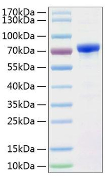 Recombinant Human Alpha-fetoprotein/AFP Protein (RPCB0326) Recombinant Human Alpha-fetoprotein/AFP Protein (RPCB0326)