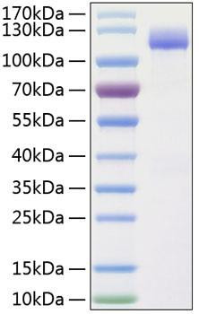 Recombinant Human ALCAM/CD166 Protein (RPCB0335)
