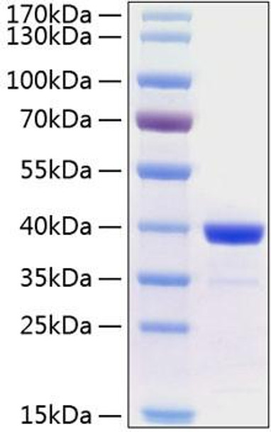 Recombinant Human Arginase 1/ARG1 Protein (RPCB0346)