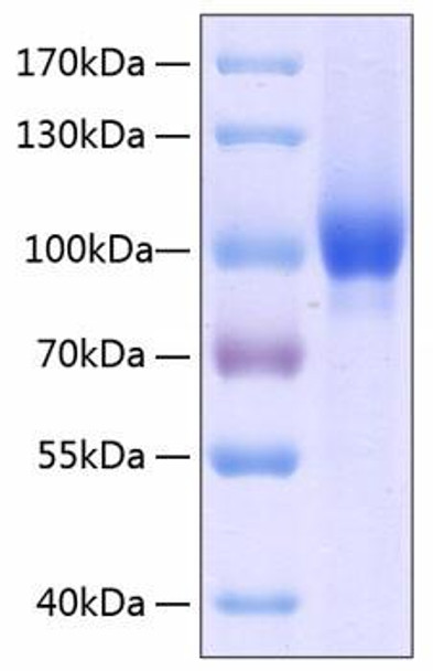 Recombinant Human Neuropilin-1/NRP1/VEGF165R/CD304 Protein (RPCB0353)