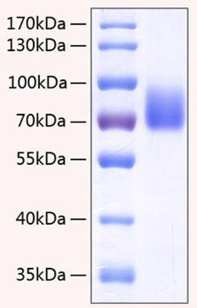 Recombinant Human SLAMF4/2B4/CD244 Protein (RPCB0386)