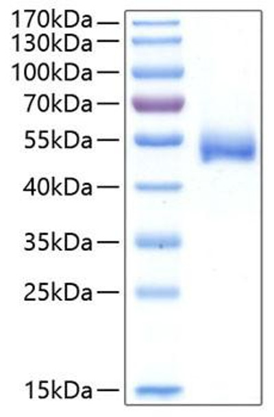 Recombinant Human Chitinase-1/CHIT1 Protein (RPCB0394)