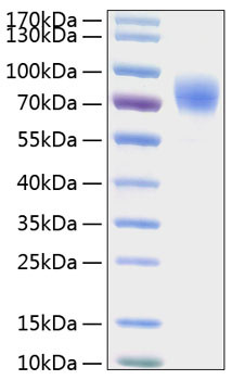 Recombinant Human Thrombopoietin/THPO Protein (RPCB0396)