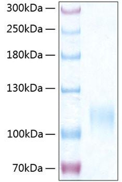 Recombinant Human E-selectin/SELE/CD62E Protein (RPCB0404)