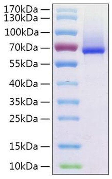 Recombinant Human Glypican-1/GPC1 Protein (RPCB0408) Recombinant Human Glypican-1/GPC1 Protein (RPCB0408)