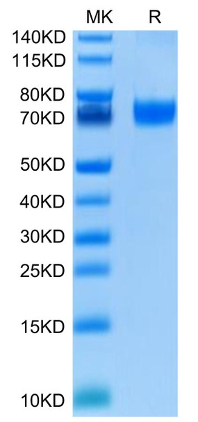 Recombinant Human B7-H5/Gi24/VISTA Protein (RPCB0418)