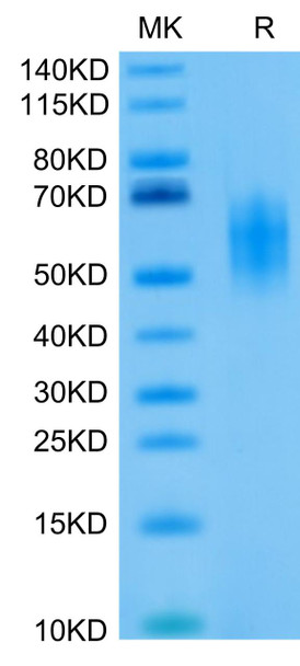 Biotinylated Recombinant Human DNAM-1/CD226 Protein (RPCB0425)