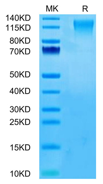 Recombinant Human TACTILE/CD96 Protein (RPCB0434)