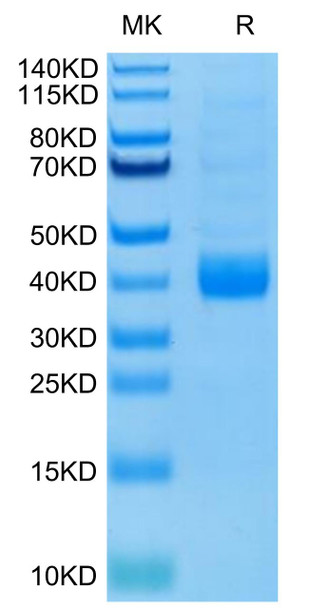 Biotinylated Recombinant Human NKp46/NCR1/CD335 Protein (Primary Amine Labeling) (RPCB0435)