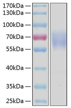 Recombinant Human LMIR1/CD300a Protein (RPCB0449)