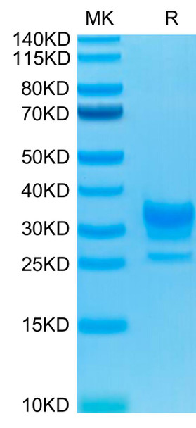 Biotinylated Recombinant Human Fc gamma RIIB/FCGR2B/CD32b Protein (RPCB0494)