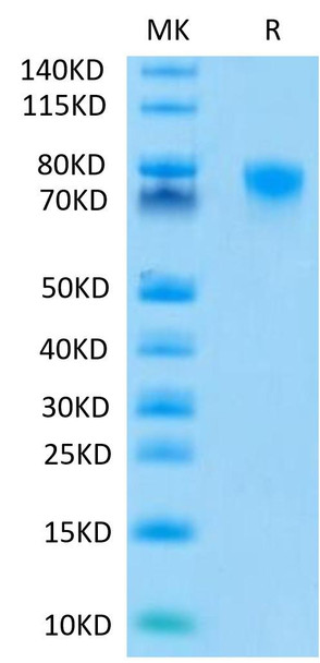 Recombinant Human TNFRSF1B/TNF-R2/CD120b Protein (RPCB0500)