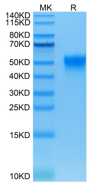 Biotinylated Recombinant Human Fc-gamma RIII alpha/FCGR3A/CD16a Protein (RPCB0533)
