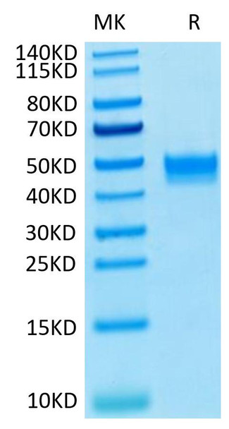 Recombinant Human FGFR-3 beta (IIIb)/CD333 Protein (RPCB0548)