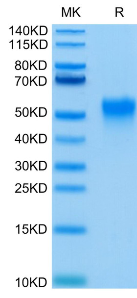 Recombinant Human Fc-gamma RIII alpha/FCGR3A/CD16a (F176V) Protein (RPCB0552)