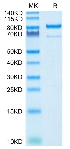 Recombinant Human 5'-Nucleotidase/NT5E/CD73 Protein (RPCB0554)