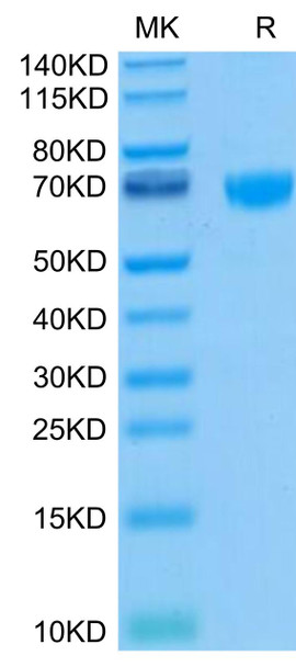 Biotinylated Recombinant Human PD-1/PDCD1/CD279 Protein (RPCB0577)