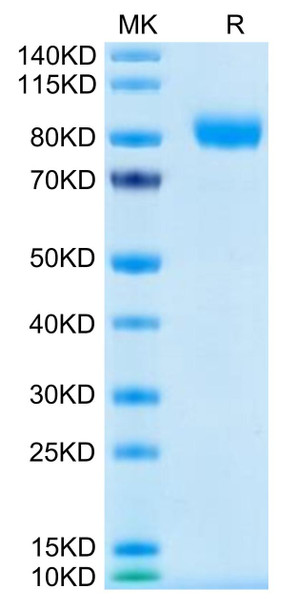 Recombinant Human CSF2RA/GM-CSF R alpha/CD116 Protein (RPCB0584)