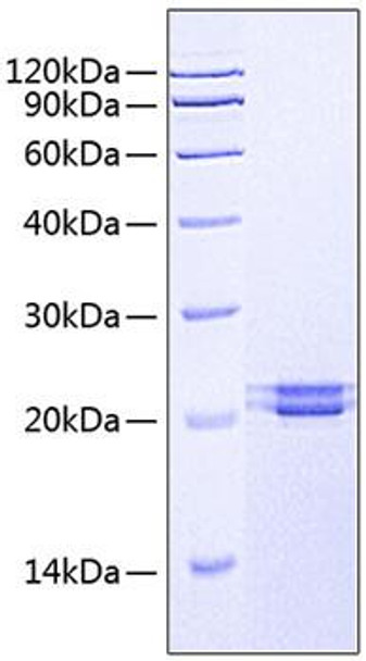 Recombinant Human FAM3C Protein (RPCB0585) Recombinant Human FAM3C Protein (RPCB0585)